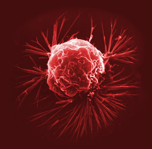 Breast cancer cell - artificially coloured scanning electron micrograph (link for source) Breast cancer cell - scanning electron micrograph (http://www.broad.mit.edu/cgi-bin/news/display_news.cgi?id=2722)