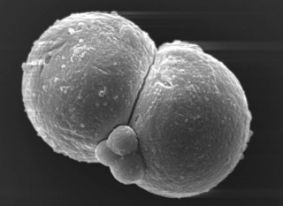 Dividing cells (link for source) Dividing cells (http://jaxmice.jax.org/library/notes/501e.html)